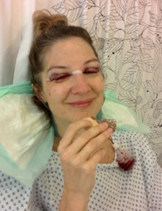 Mary, following migraine surgery in 2014